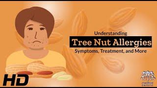 Tree Nut Allergies 101: A Comprehensive Guide to Your Health