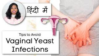 योनि संक्रमण - Vaginal Yeast Infections - Causes, Treatment, Prevention in Hindi