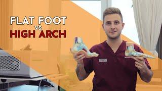 Is Having a High Arch Worse than a Flat Foot? - Lewis Nurney, Singapore Podiatrist