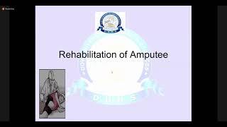 Management of Amputee | Rehabilitation
