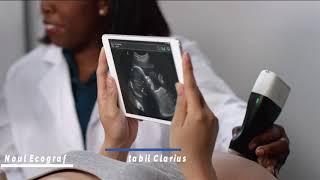 Clarius C3 HD in obstetrica-ginecologie