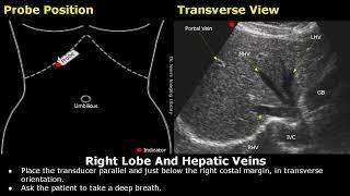 Liver Ultrasound Probe Positioning | Transducer Placement For Liver Scanning | Abdominal USG