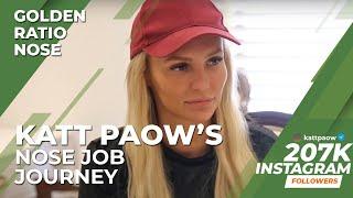 Katt Paow's Rhinoplasty Experience in Turkey 