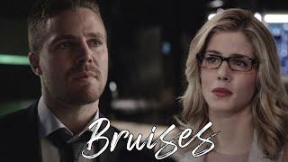 Oliver & Felicity | Bruises