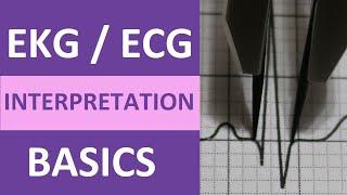 EKG/ECG Interpretation Basics Nursing NCLEX | QRS Complex, P Wave, T Wave, PR Interval