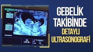 Gebelik Takibinde Detaylı Ultrasonografi | Prof. Dr. Arda Lembet