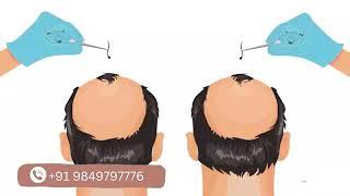 Transform Your Look | Hair Transplant in Vizag | Dr. VJs Cosmetic Surgery & Hair Transplantation