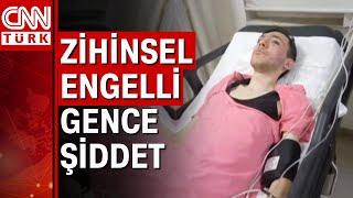 21 yaşındaki zihinsel engelli genci "karıma baktın" diyerek öldüresiye dövdüler