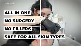 Morpheus8 -  $80 a month - Skin Tightening, Botox and Lip Fillers by Skinsation LA, Los Angeles, CA