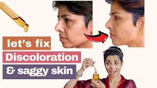 3 At Home Remedies to Correct DISCOLORATION n and Prevent Face from SAGGING