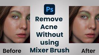 Remove Acne Without Using Mixer Brush Tool | Tips & Tricks| NextGen Graphics #acneremove #photoshop