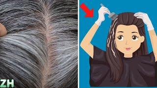 ️Most Common Causes of Grey Hair That You Must Know