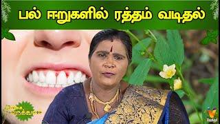 பல்  ஈறுகளில் ரத்தம் வடிதல் | Natural medicine for Gums bleeding | Mooligai Maruthuvam | Vendhar TV
