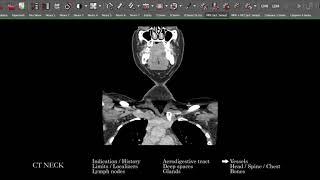 [CT] Neck | Search Pattern