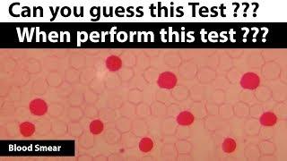 Can you guess this laboratory Test ??? ( Hematology Q&A  - 6 )