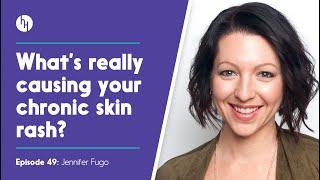 Hidden Causes Of Rashes, Eczema, Psoriasis, Rosacea - Jennifer Fugo, Ep 49