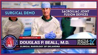 Sacroiliac Joint Fusion Devices - Douglas P  Beall, M.D.