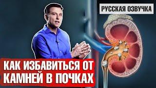 Камни в почках: Как избавиться? (русская озвучка)