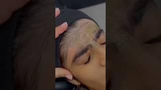 Facial hair removal free at home #shorts #facialhairs #beauty #deadskin #viral #youtube