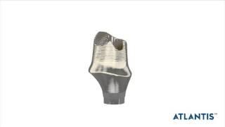 Atlantis™ abutments− Atlantis Morph | Dentsply Sirona