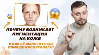 Почему возникает пигментация на коже? Как вылечить пигментацию на лице без помощи косметолога?