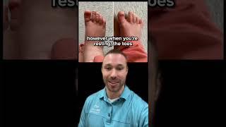 His FEET Look CRAZY!