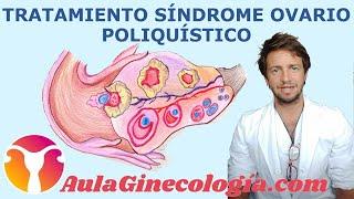 SÍNDROME de OVARIO POLIQUÍSTICO: TRATAMIENTO... FERTILIDAD y EMBARAZO  - Ginecología y Obstetricia -