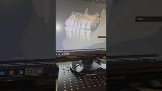 3D Smile Scanning!