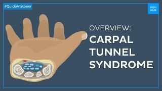 Carpal tunnel syndrome: Symptoms, causes, treatment - Quick Anatomy | Kenhub