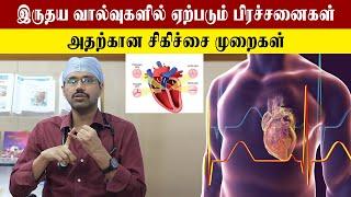 Valve Heart Disease Treatment Part-2 | What are Heart Valve Treatments? | Samayam Tamil