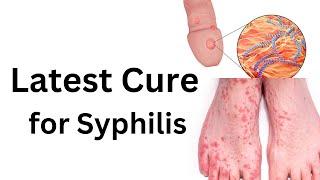 Latest treatment of syphilis. How to cure any stage of syphilis
