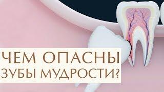  Для чего нужны зубы мудрости, стоит или нет их удалять. Удалять или нет зуб мудрости. 12+