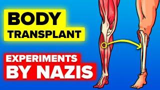 Body Transplantation - Nazi Camp Experiments