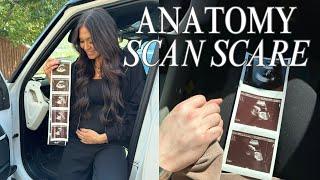 anatomy scan scare