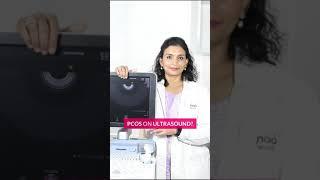 PCOS on Ultrasound? | Dr. Priya Kalyani