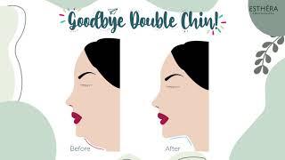 Cara Hilangkan Double chin