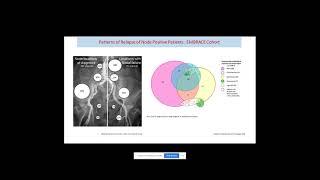 Stretching Therapeutic Horizon in Primary and Recurrent Ca Cervix_Prof. Supriya Chopra_TMH Mumbai