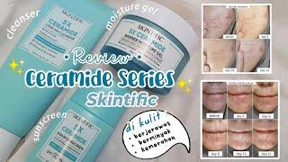 SKINTIFIC 5X CERAMIDE SERIES | REVIEW DI KULIT BERMINYAK BERJERAWAT | BISA UNTUK BASIC SKINCARE