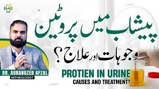 Protein In Urine Causes & Treatment | Peshab Mein Protein Aane Ka Ilaj | Protein Leak in Urine