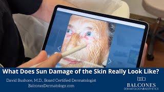 What Does Sun Damage of the Skin Really Look Like? | David Bushore, MD, FAAD | Ph: 512-459-4869