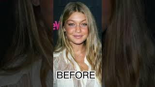 GIGI HADID BEFORE AFTER WITHOUT MAKEUP SURGERY SHORTS 2023