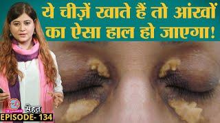 आंखों के पास पीले चकत्ते पड़ जाएंगे अगर ये गलतियां जारी रखीं | Xanthelasma|Cholesterol|Sehat ep 134