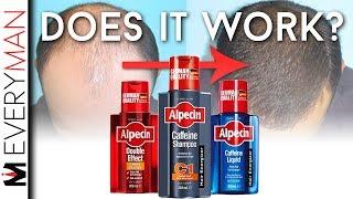 DOES CAFFEINE SHAMPOO WORK? | Alpecin REVIEW & Hair Growth Alternatives