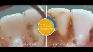 The impacts of ultrasonic insert tip wear | Dentsply Sirona