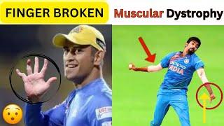 6 Big Cricketer Who are Physically disabled