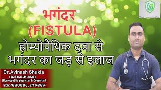 फिस्टुला (भगन्दर ) का बिना आपरेशन जड़ से इलाज, BEST HOMEOPATHIC MEDICINE FOR ANAL FISTULA ,