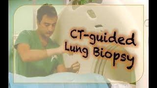 CT-guided Lung Biopsy procedure and technique