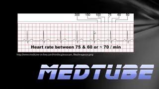 How to read an ECG easily