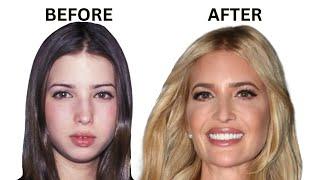 Ivanka Trump's Plastic Surgery Secrets: Shocking Upgrades Revealed!