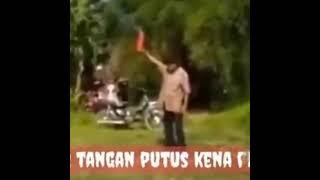 BUNTUNG NYAH TANGAN BAPA INIH KENA PETASAN DAH MENG GEGERKAN PARA WARGA